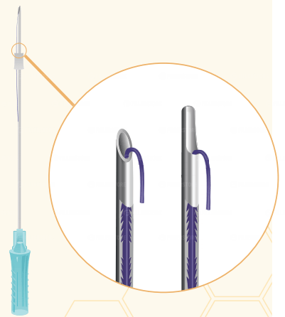 Мезонити Honey Derma Thread PDO COG 2R FC type L cannula 19Gx100mm - 170mm (Хани Дерма Фред)