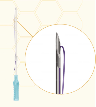 Мезонити Honey Derma Thread PDO MONO 26Gx38mm - 60mm (Хани Дерма Фред)