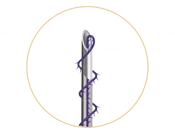 Мезонити Honey Derma Thread PDO COGGING SCREW+DSP type 25Gx38mm - 136mm (Хани Дерма Фред)