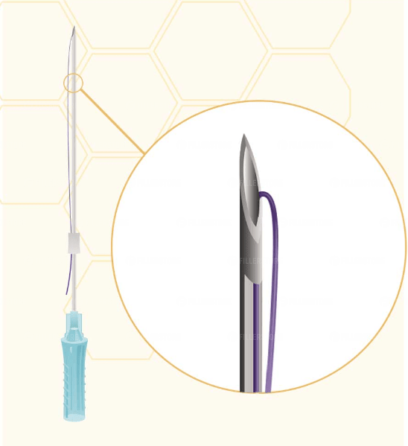 Мезонити Honey Derma Thread PDO MONO 27Gx38mm - 60mm (Хани Дерма Фред)