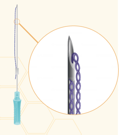 Мезонити Honey Derma Thread PDO TWIST 26Gx38mm - 60mm (Хани Дерма Фред)