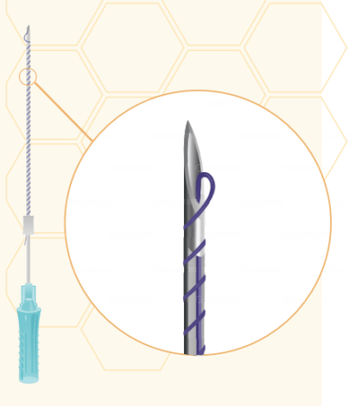 Мезонити Honey Derma Thread PDO SCREW 26Gx50mm - 80mm (Хани Дерма Фред)