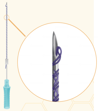 Мезонити Honey Derma Thread PDO DOUBLE SCREW 26Gx90mm - 160mm (Хани Дерма Фред)