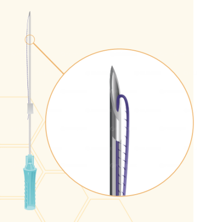 Мезонити Honey Derma Thread PDO DOUBLE COG L cannula 23Gx90mm - 160mm (Хани Дерма Фред)